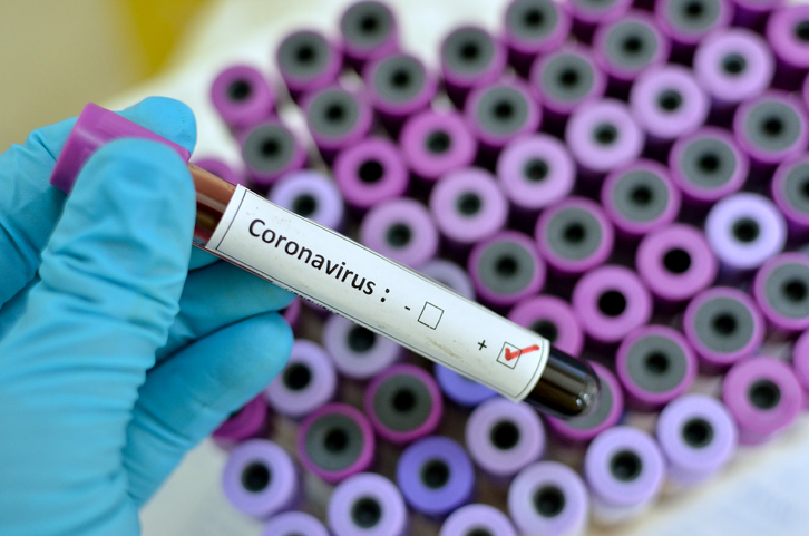 Emergenza Coronavirus: ospedali religiosi in prima  linea, più di 100 medici contagiati.  “Fare chiarezza sulla Sanità Privata”