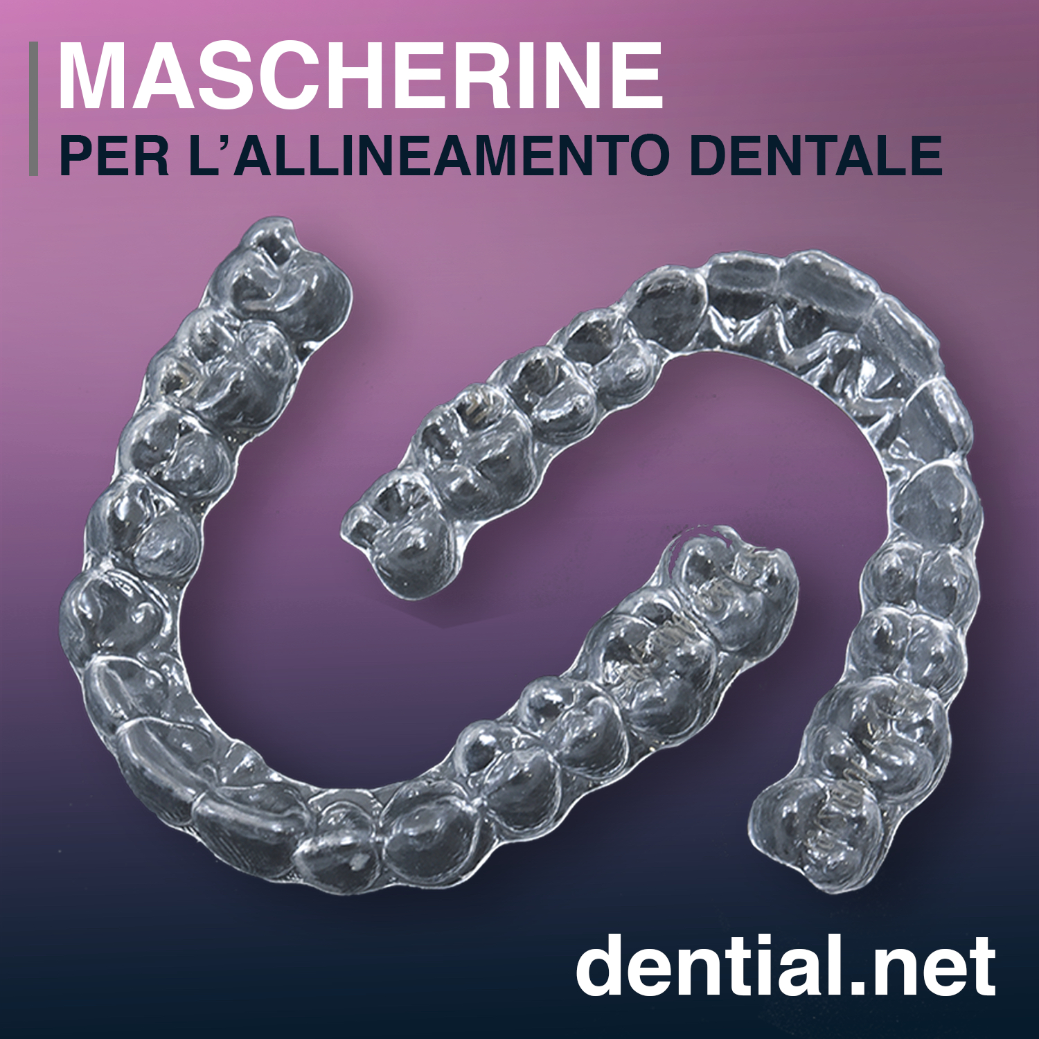 Mascherine dentali invisibili per l’allineamento dei denti storti