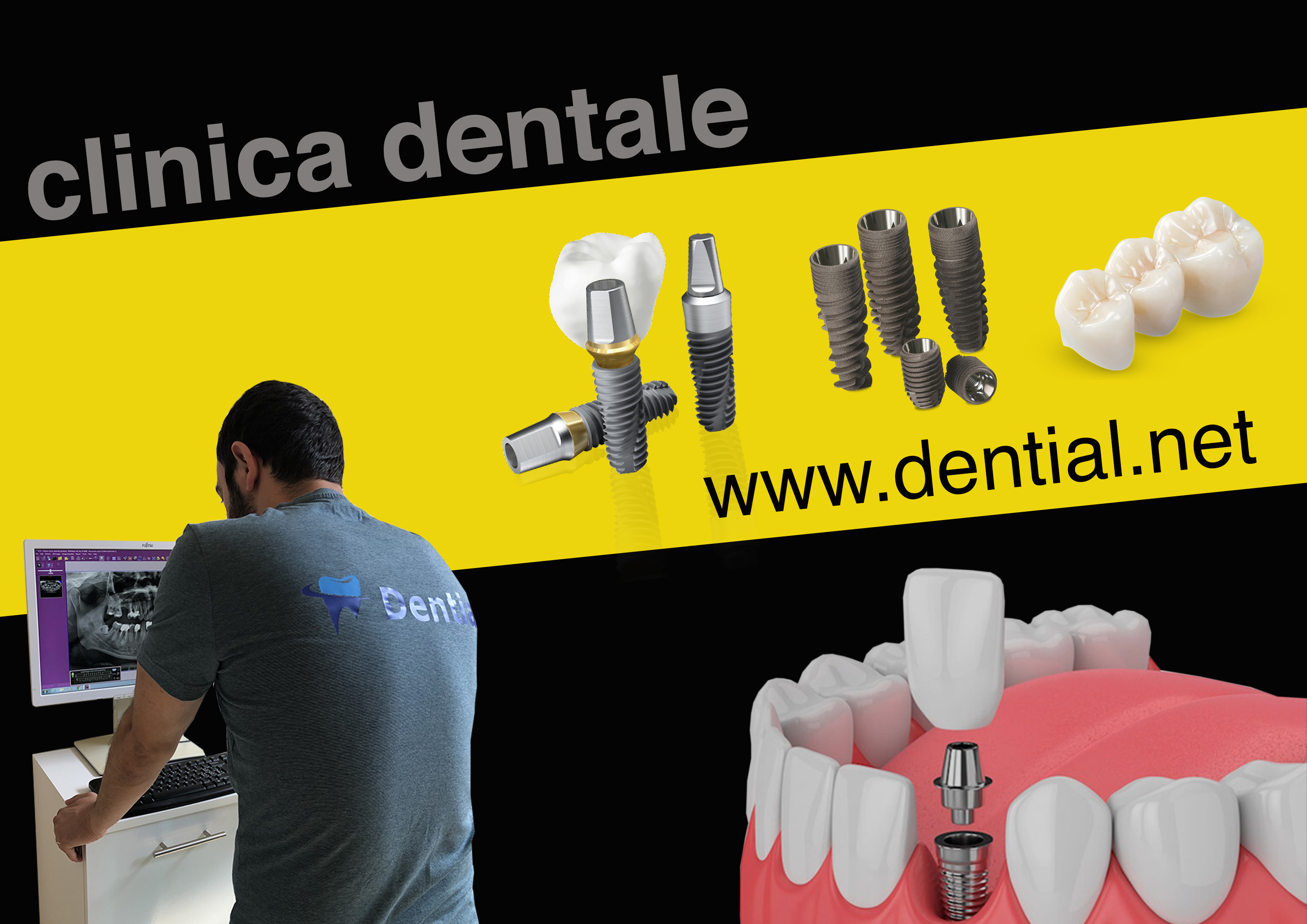 Cure dentali all’estero, Croazia e Albania sono la prima scelta degli italiani