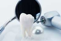 Otturazione retrograda dei canali dentali