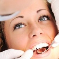 Sbiancamento denti: soluzione fai da te oppure è meglio quella professionale?