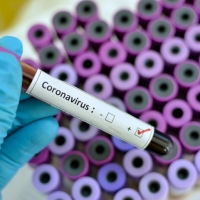 Emergenza Coronavirus: ospedali religiosi in prima  linea, pi� di 100 medici contagiati.  �Fare chiarezza sulla Sanit� Privata�
