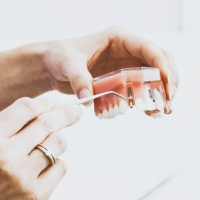 E' meglio riparare una dentiera o comprarla nuova?