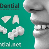 Foto 6 - Denti in ceramica e porcellana, Dential il tuo Dentista in Albania