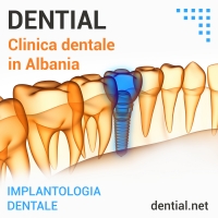 Dentisti in Croazia l’alternativa è nelle cliniche in Albania