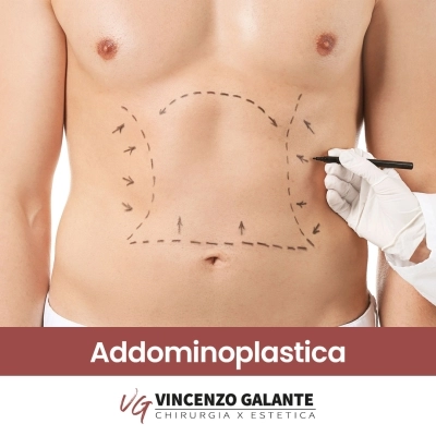 Addominoplastica a Roma | Dott. Vincenzo Galante