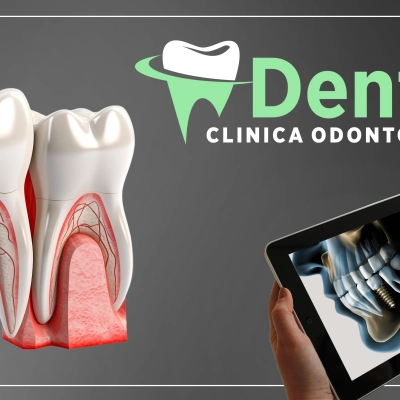 Quale è la migliore clinica dentale Albania?