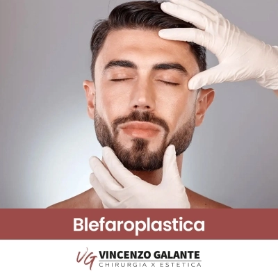 Blefaroplastica palpebre cadenti  o borse palpebrali Dott. Vincenzo Galante a Roma