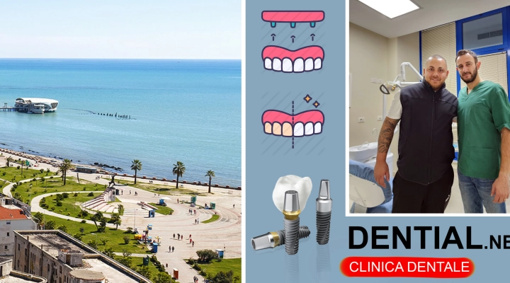 Le opportunità del turismo dentale per l'economia in Albania e i vantaggi per i pazienti italiani